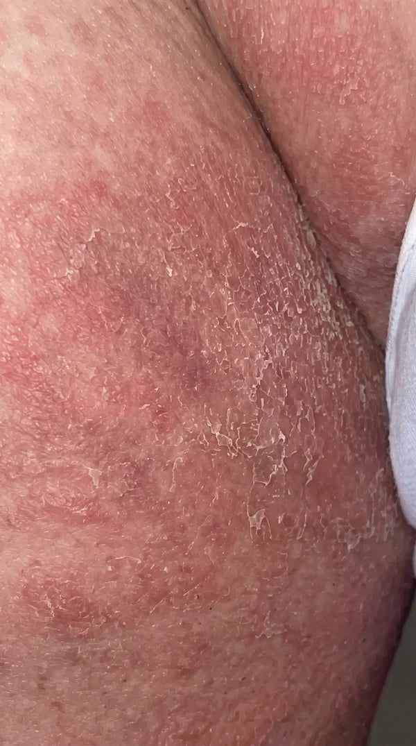 Voor