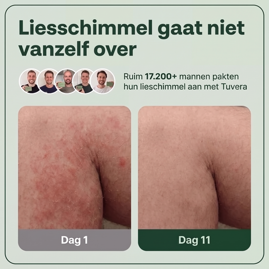 Tuvera Antischimmel Zeep